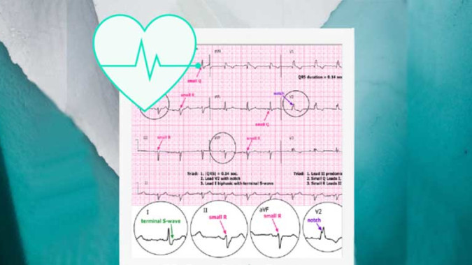 150 ecg cases pdf image