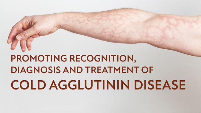 Promoting Recognition, Diagnosis and Treatment of CAD