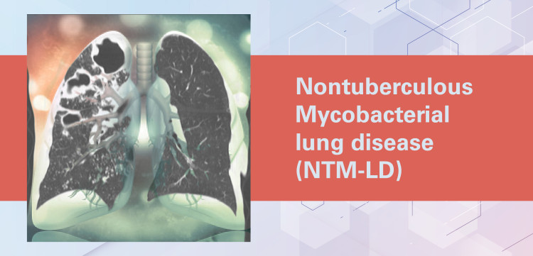 Free Respiratory Ceus Ceus Forrespiratory Therapists On Mycme