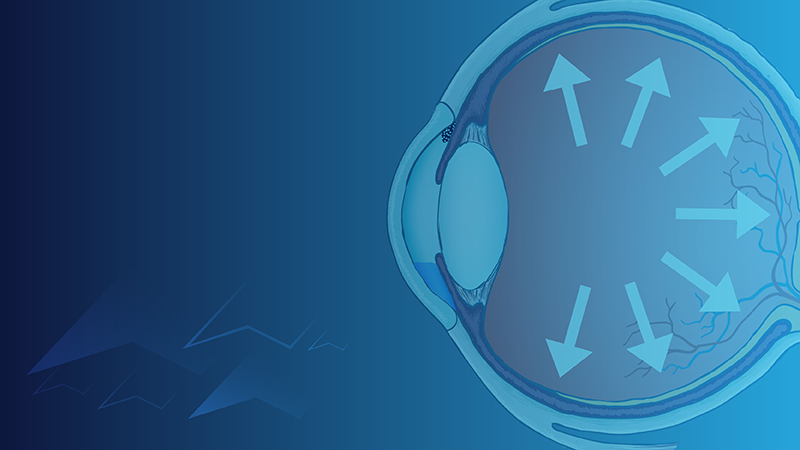 Optometry CE Courses - Optometry Advisor