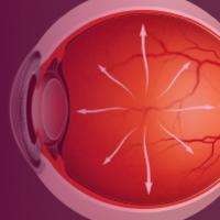 Optimizing Outcomes in Glaucoma Management - Applying Evidence to Practice With a Multitude of Treatment Options