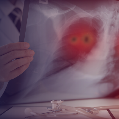 Mastering Advances in Managing Unresectable and Metastatic NSCLC—Immunotherapy, Targeted Therapies, and Emerging Strategies
