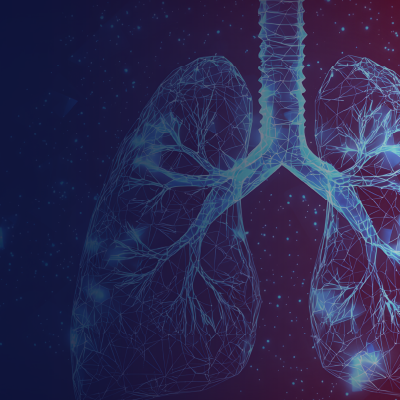 Advancing Outcomes in Limited-Stage Small Cell Lung Cancer: From Evidence to Practice