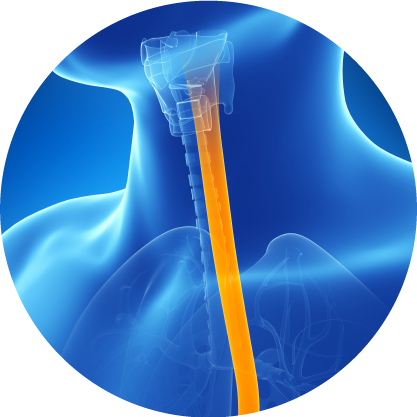 The Evolving Treatment Paradigm for the Management of Eosinophilic Esophagitis and the Future of Oral Therapies