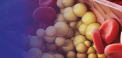 Understanding the Role of PCKS9 Inhibitors in the Management of Hyperlipidemia