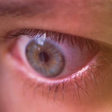 **NEW** - Cases & Conversations ™: Advancing the Optimal Diagnosis & Treatment of Thyroid Eye Disease