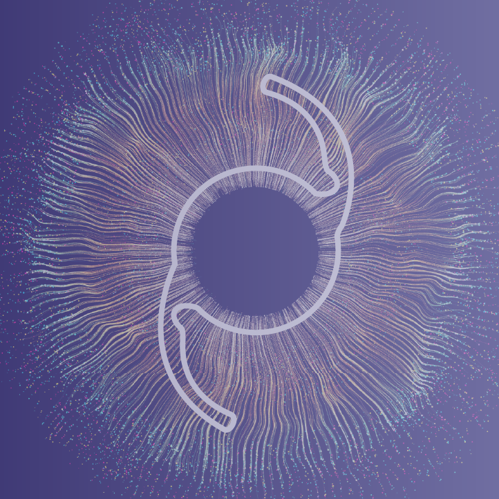 Toric IOLs Unleashed: From Technological Progress to Patient Success