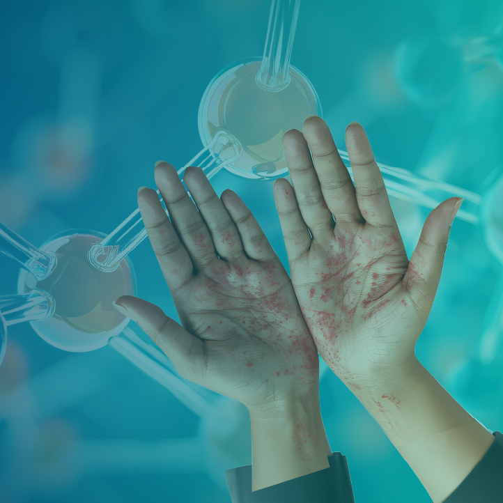 Dermalorian™ Webinar: Where Do Biologics Fit into the Management of Moderate to Severe Atopic Dermatitis?