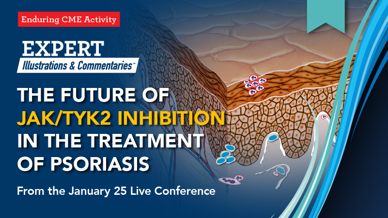 Expert Illustrations and Commentaries Live: The Future of JAK/TYK2 Inhibition in the Treatment of Psoriasis