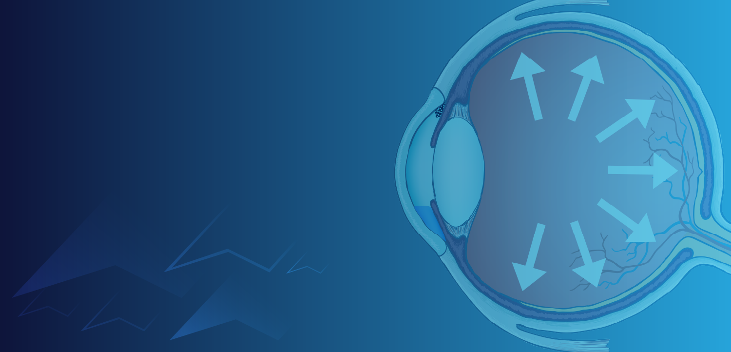 (CME Track) Visionary Approaches: Rethinking Therapeutic and Interventional Glaucoma Management