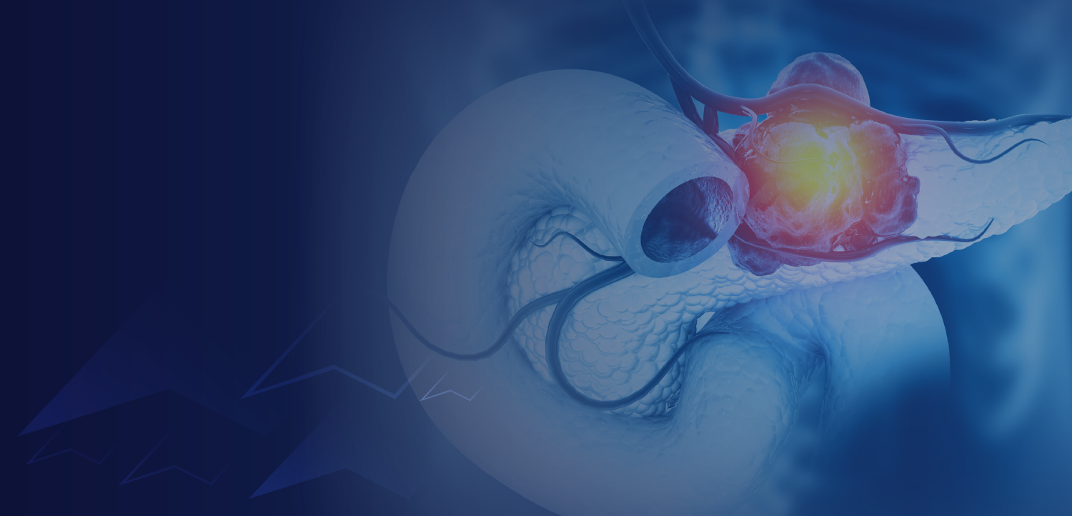  Molecular Testing and Personalized Strategies in Pancreatic Cancer: Targeting NRG1 and Rare Drivers With an Optimized Approach