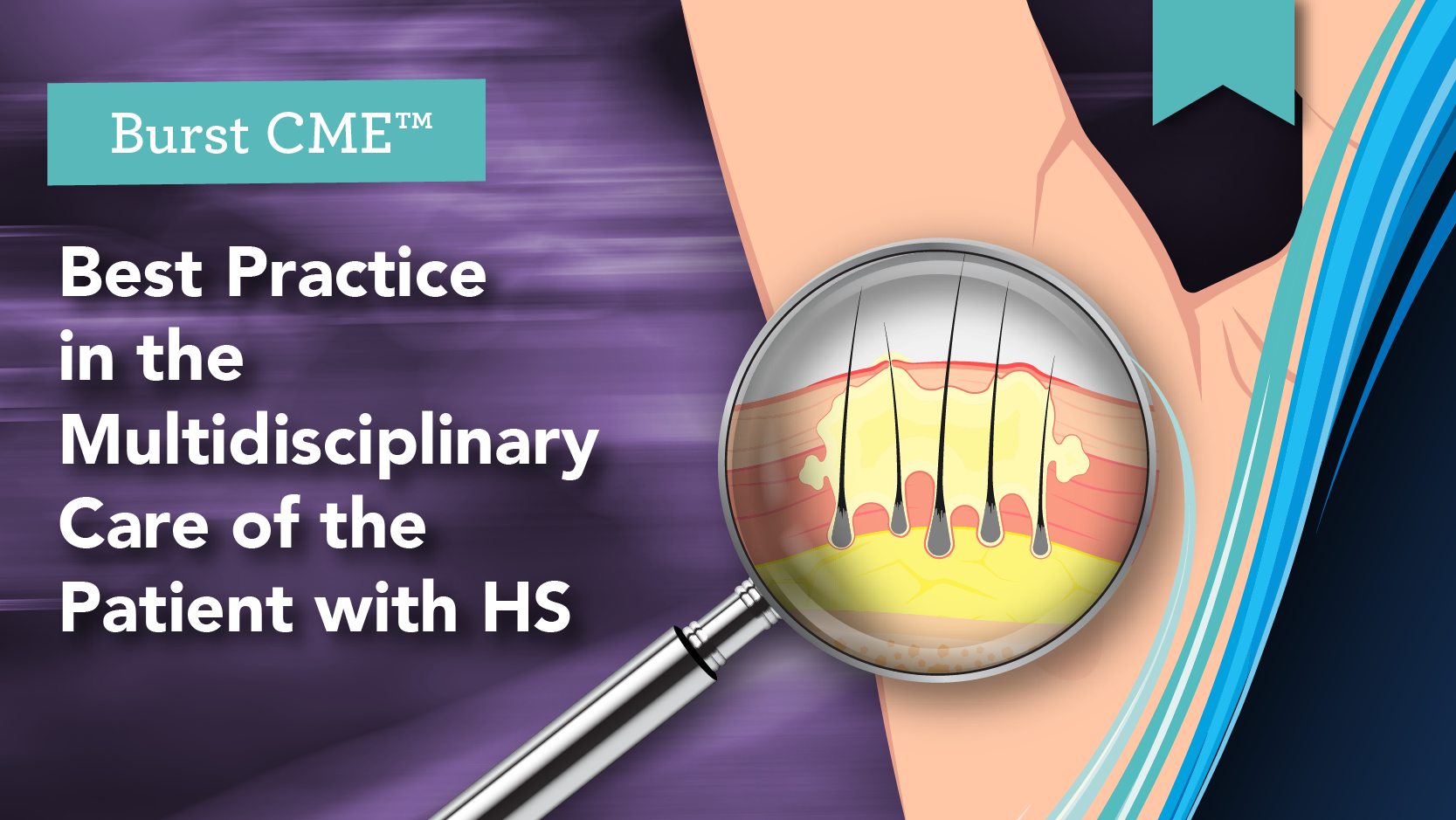 Best Practice in the Multidisciplinary Care of the Patient with HS