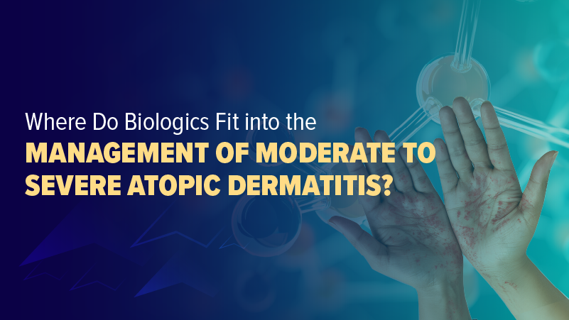 Where Do Biologics Fit Into the Management of Moderate-to-Severe Atopic ...