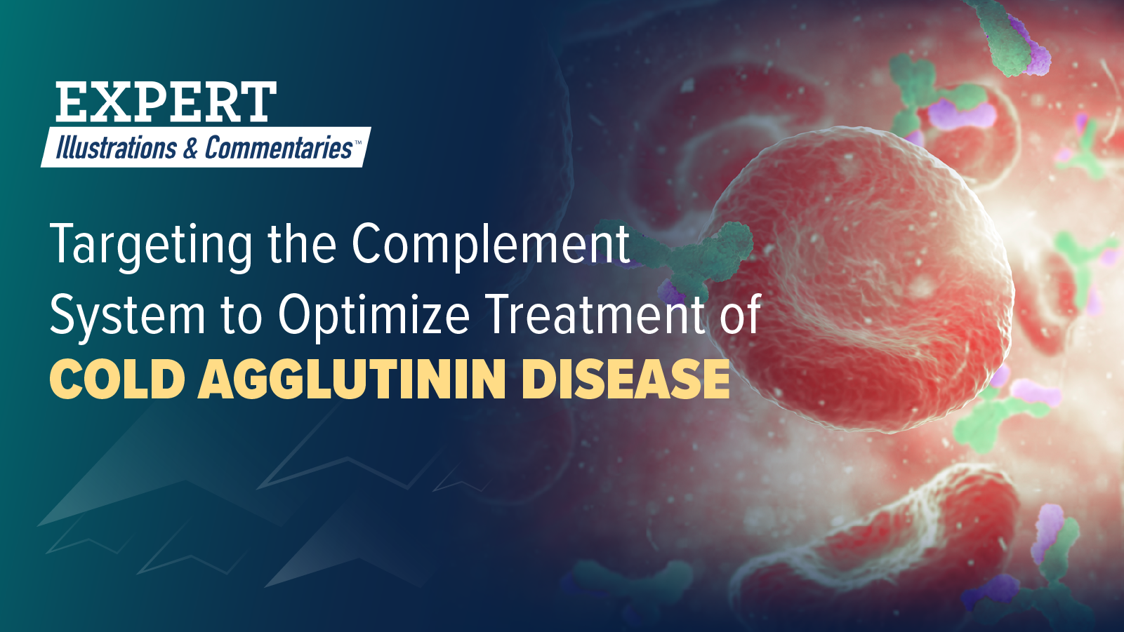 Expert Illustrations & Commentaries™: Targeting the Complement System to Optimize Treatment of Cold Agglutinin Disease