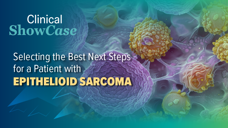 Clinical Showcase™: Selecting the Best Next Steps for a Patient with Epithelioid Sarcoma