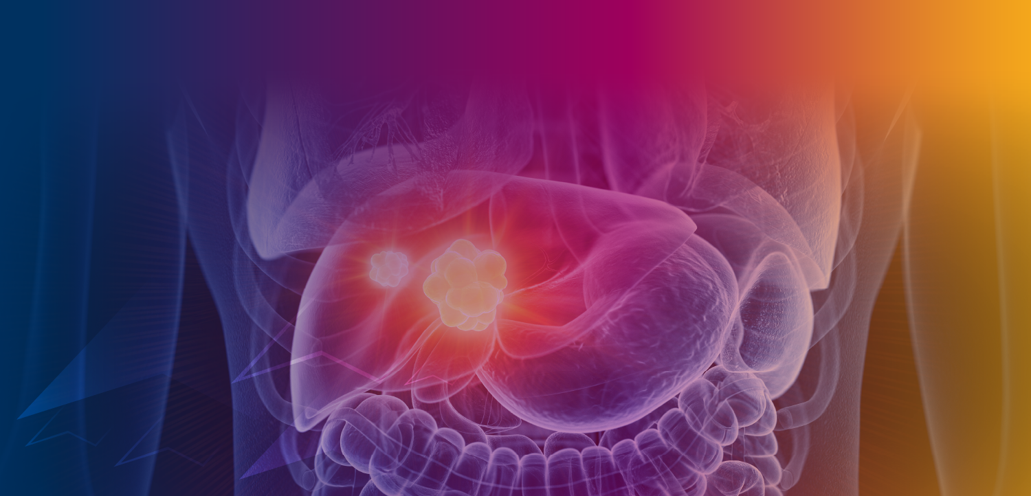 PER® Liver Cancer Tumor Board: How Do Evolving Data for Immune-Based Strategies in Resectable and Unresectable HCC Impact Multidisciplinary Patient Management Today… and Tomorrow?