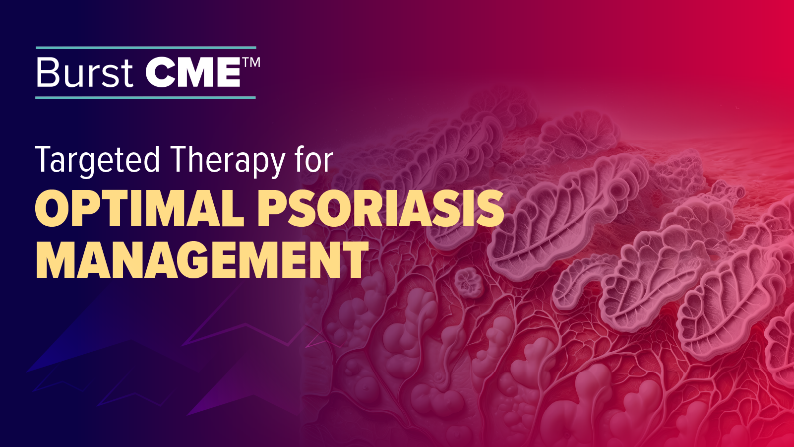 Burst CME: Targeted Therapy for Optimal Psoriasis Management