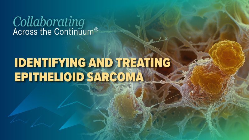 Collaborating Across the Continuum®: Identifying and Treating Epithelioid Sarcoma