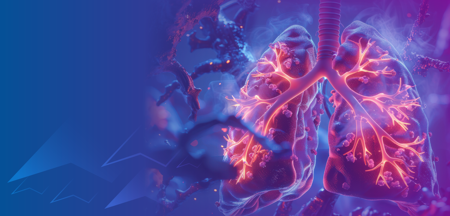 (MOC and CME Credit) New Frontiers in Immunotherapy for SCLC: Insights From Latest Clinical Trials and Their Application in Real-World Treatment