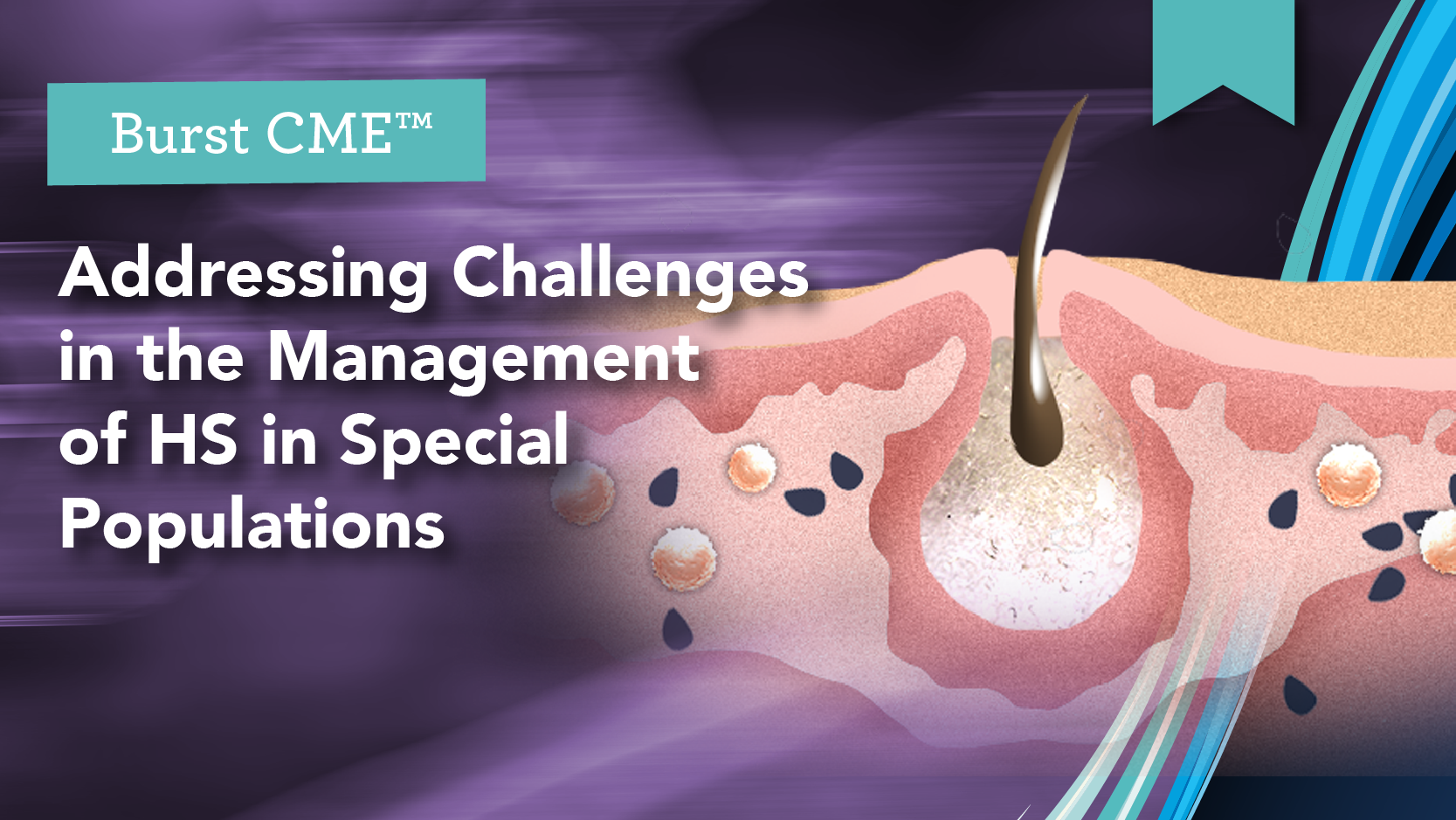 Addressing Challenges in the Management of HS in Special Populations