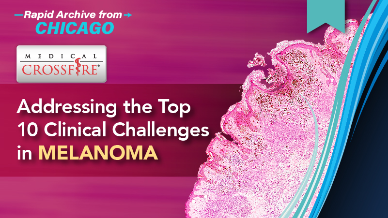 Medical Crossfire®: Addressing the Top 10 Clinical Challenges in Melanoma