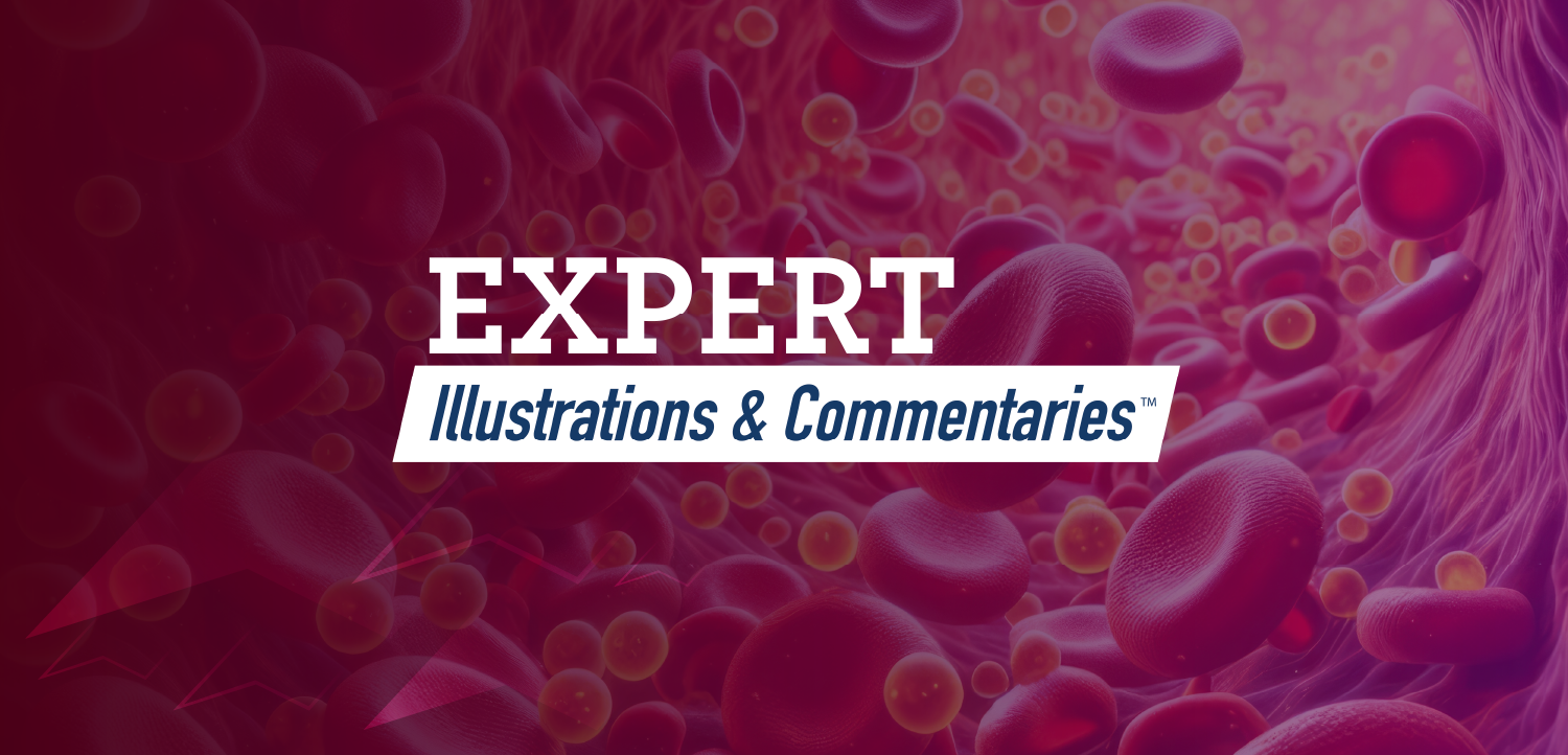  Raising Our Game in the Management of Hyperlipidemia: New Targets, New Tactics
