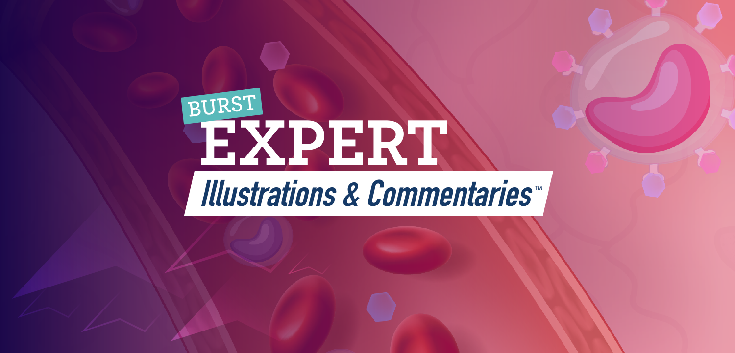 BURST Expert Illustrations and Commentaries™: Exploring the Mechanistic Rationale for CSF-1R– Directed Treatment in Chronic GVHD