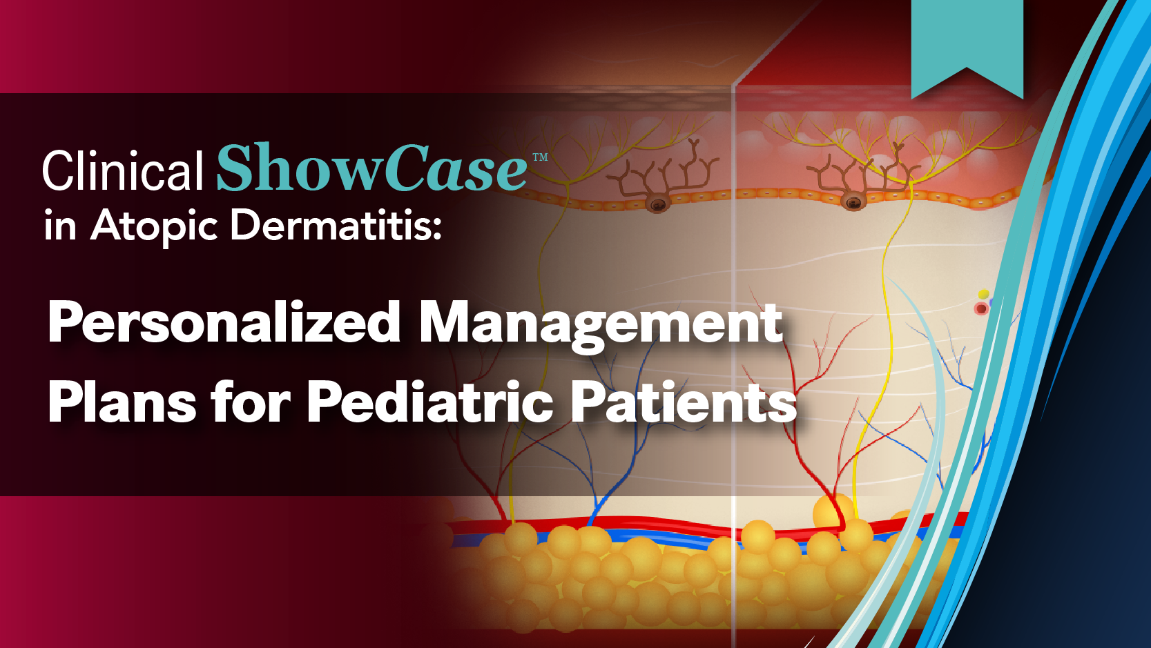 Clinical ShowCase™ in Atopic Dermatitis: Personalized Management Plans for Pediatric Patients