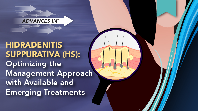 Advances in™ Hidradenitis Suppurativa (HS): Optimizing the Management Approach with Available and Emerging Treatments