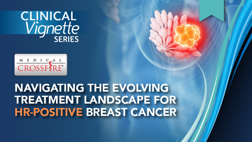 Clinical Vignette Series: Navigating the Evolving Treatment Landscape for HR-Positive Breast Cancer