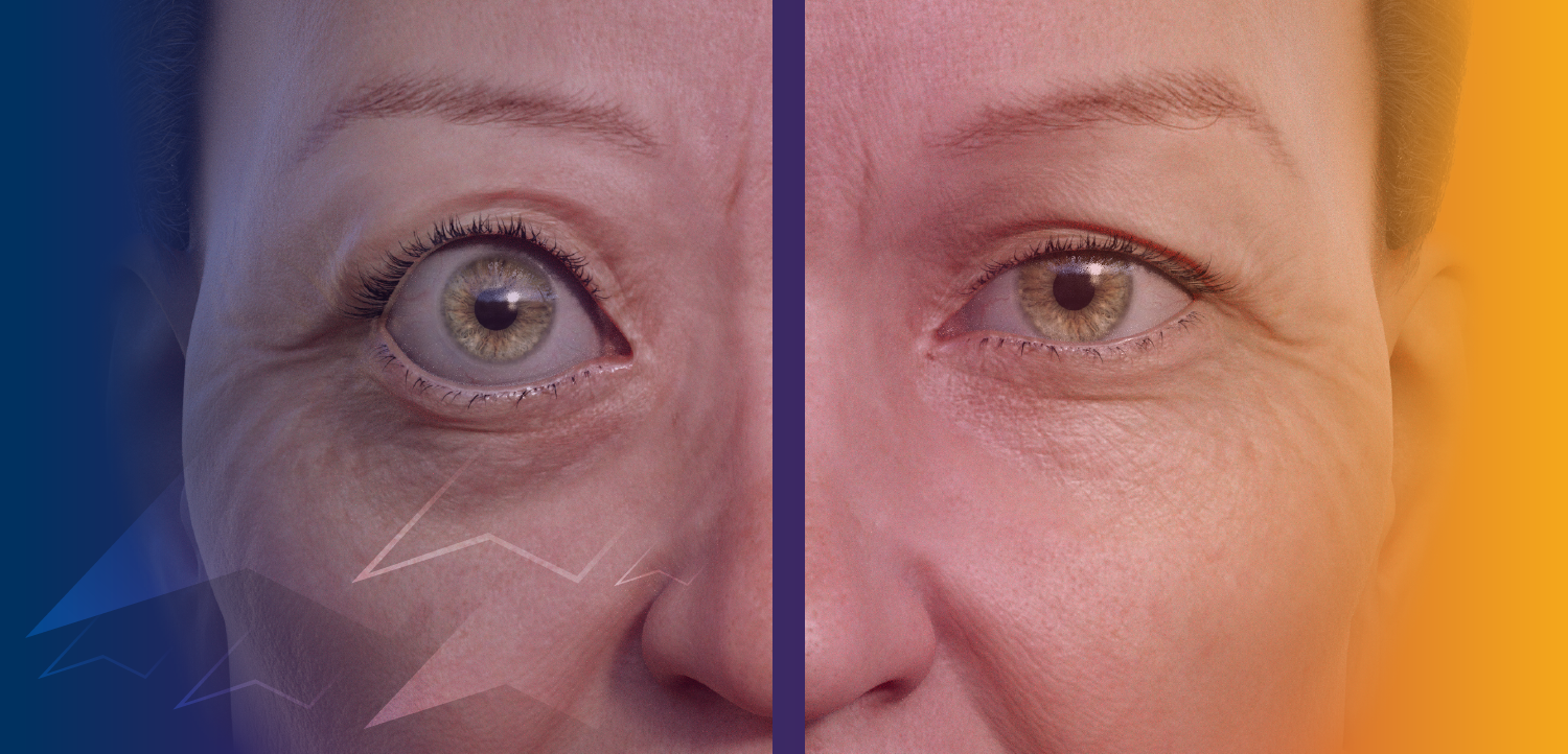 (CME Track) The TED Perspective: A Multidisciplinary Approach to Thyroid Eye Care