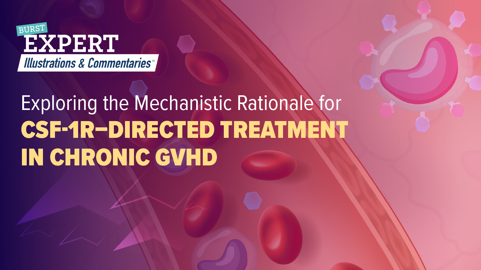 BURST Expert Illustrations and Commentaries™: Exploring the Mechanistic Rationale for CSF-1R– Directed Treatment in Chronic GVHD