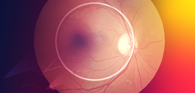 (CME Track) Clinical Case Connections: Expert Insights on Applying Therapeutic Innovations in nAMD