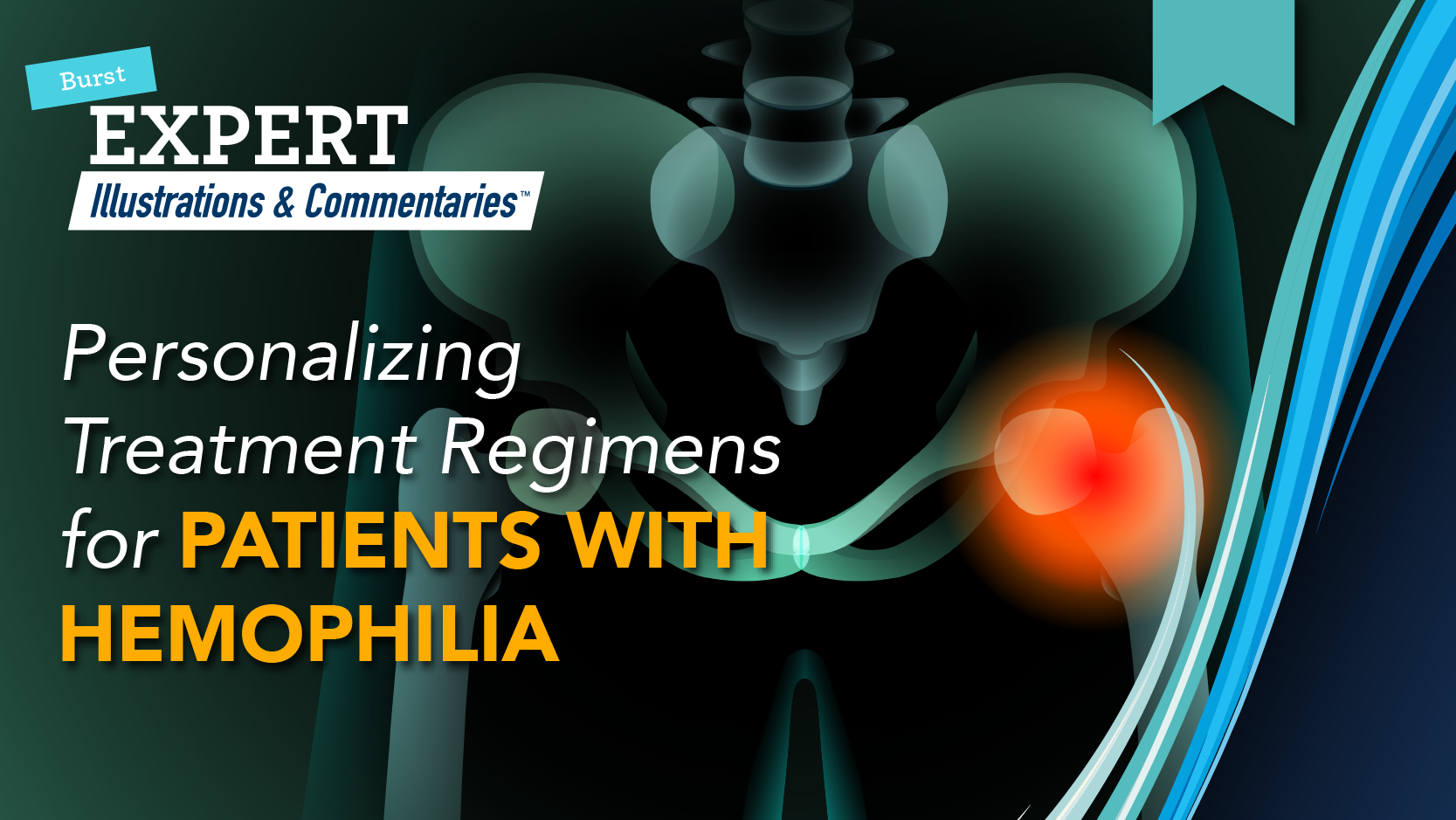 BURST Expert Illustrations & Commentaries™: Personalizing Treatment Regimens for Patients with Hemophilia