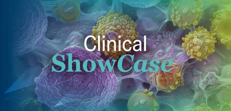 Clinical Showcase™: Selecting the Best Next Steps for a Patient with Epithelioid Sarcoma
