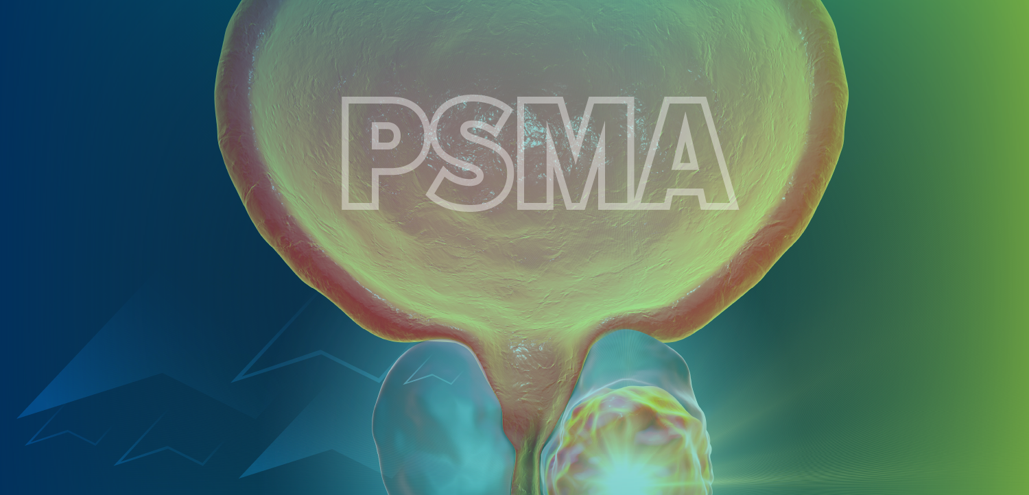 Homing in on the Role of PSMA in Prostate Cancer – Harnessing the Power of Precision Medicine Through Imaging and Therapy to Individualize Treatment Plans