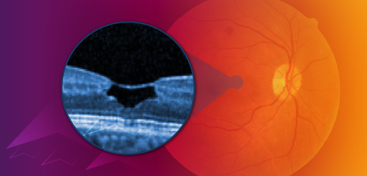 Join us at The Ophthalmology Meeting in Orlando this October