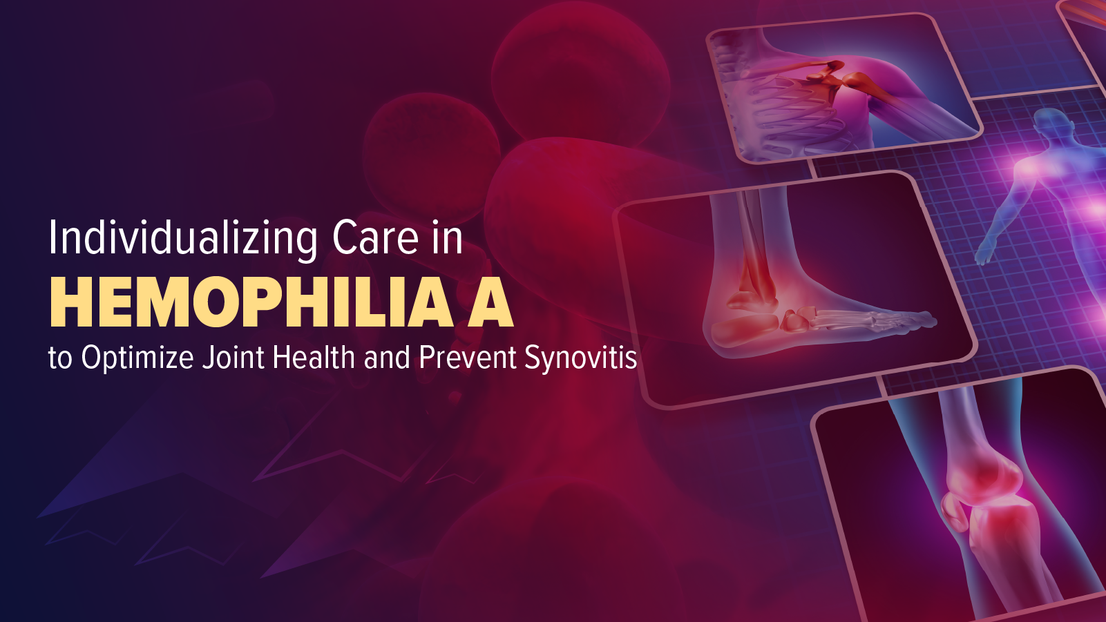 Patient, Provider, & Caregiver Connection: Individualizing Care in Hemophilia A to Optimize Joint Health and Prevent Synovitis