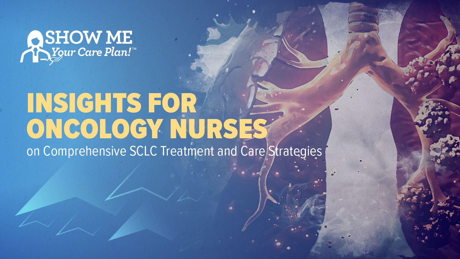 Show Me Your Care Plan!™ Insights for Oncology Nurses on Comprehensive SCLC Treatment and Care Strategies