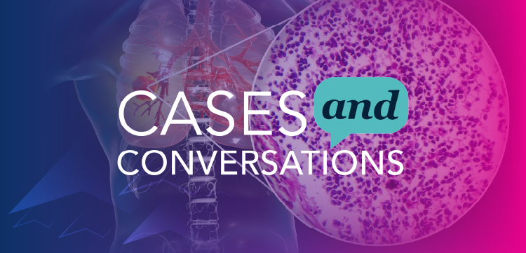 Cases & Conversations™: Expert Perspectives on Leveraging Recent Advances to Transform SCLC Treatment
