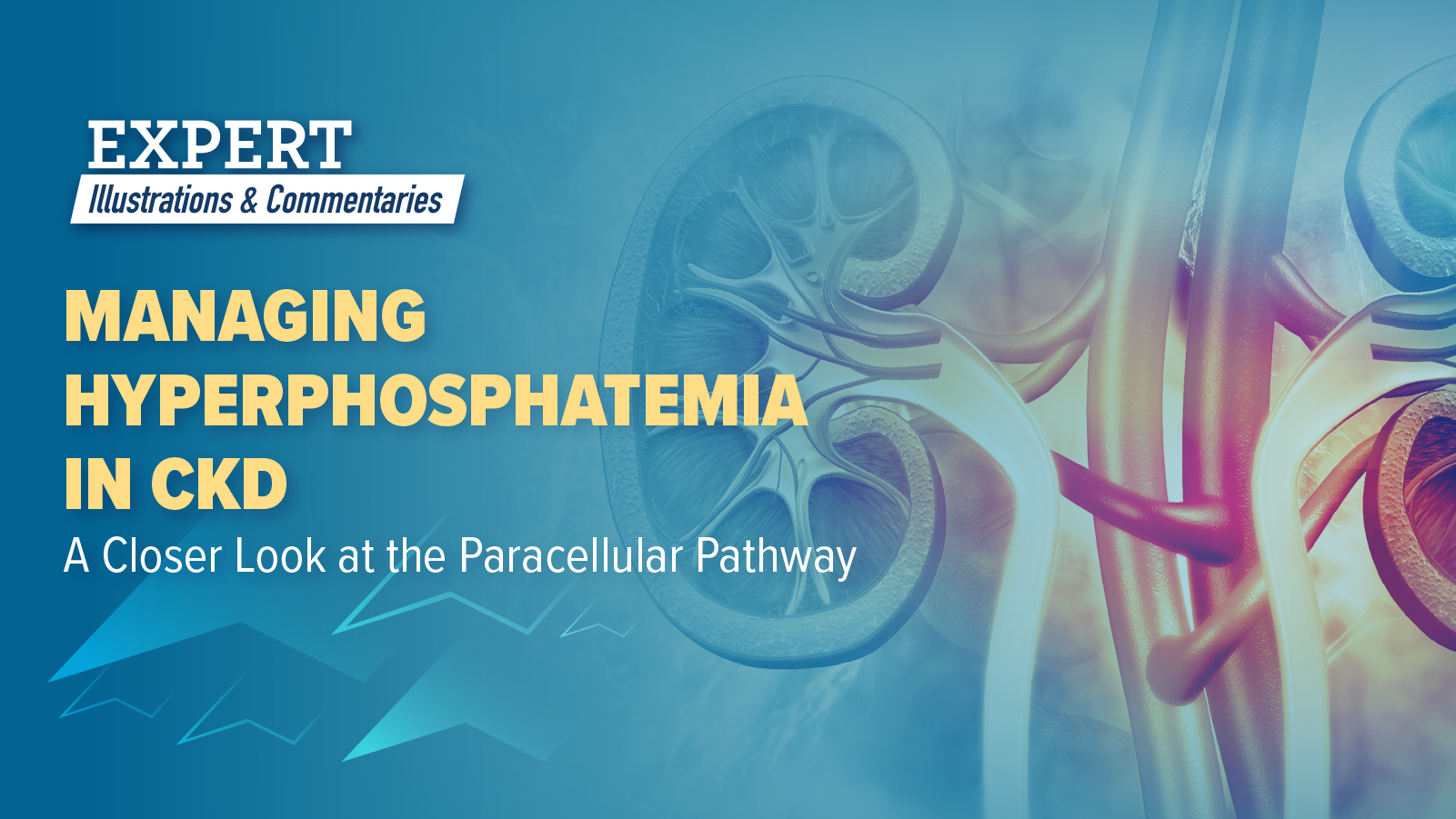 Expert Illustrations and Commentaries™: Managing Hyperphosphatemia in CKD—A Closer Look at the Paracellular Pathway