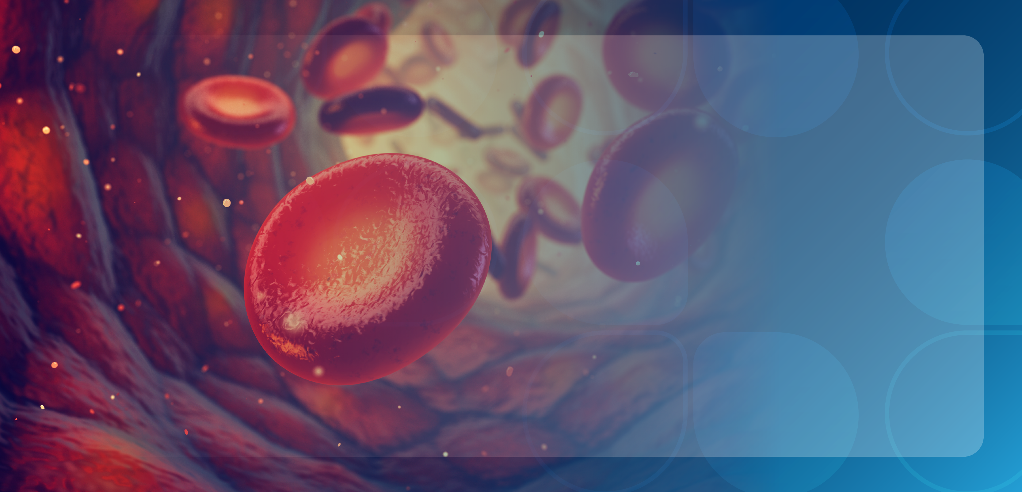 Clinical Updates in the Management of Paroxysmal Nocturnal Hemoglobinuria With Patient Perspectives