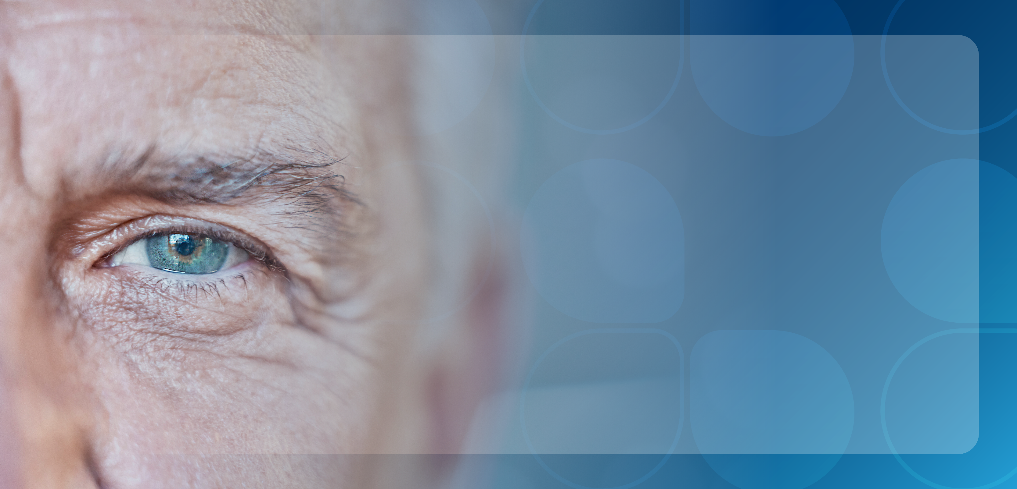Reducing the Treatment Burden of AMD and DME: A Comprehensive Guide to New Dosing Strategies of Anti-VEGF Therapies