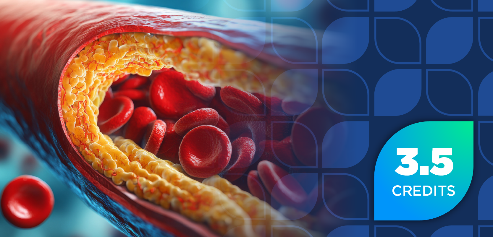 Navigating Adherence to Hyperlipidemia Treatment Guidelines and Non-Statin Therapies