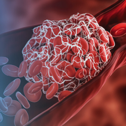 Direct Oral Anticoagulants for Prevention of Venous Thromboembolism Events in Acutely Ill Patients: A Comprehensive Guide for the Pharmacist