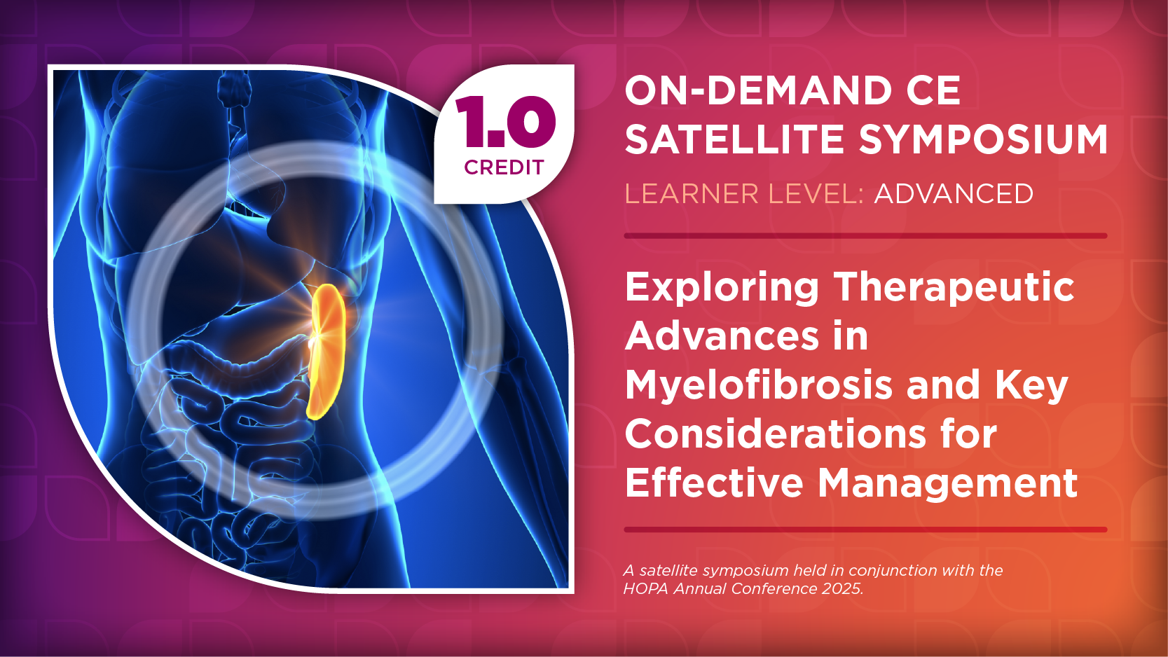Exploring Therapeutic Advances in Myelofibrosis and Key Considerations for Effective Management
