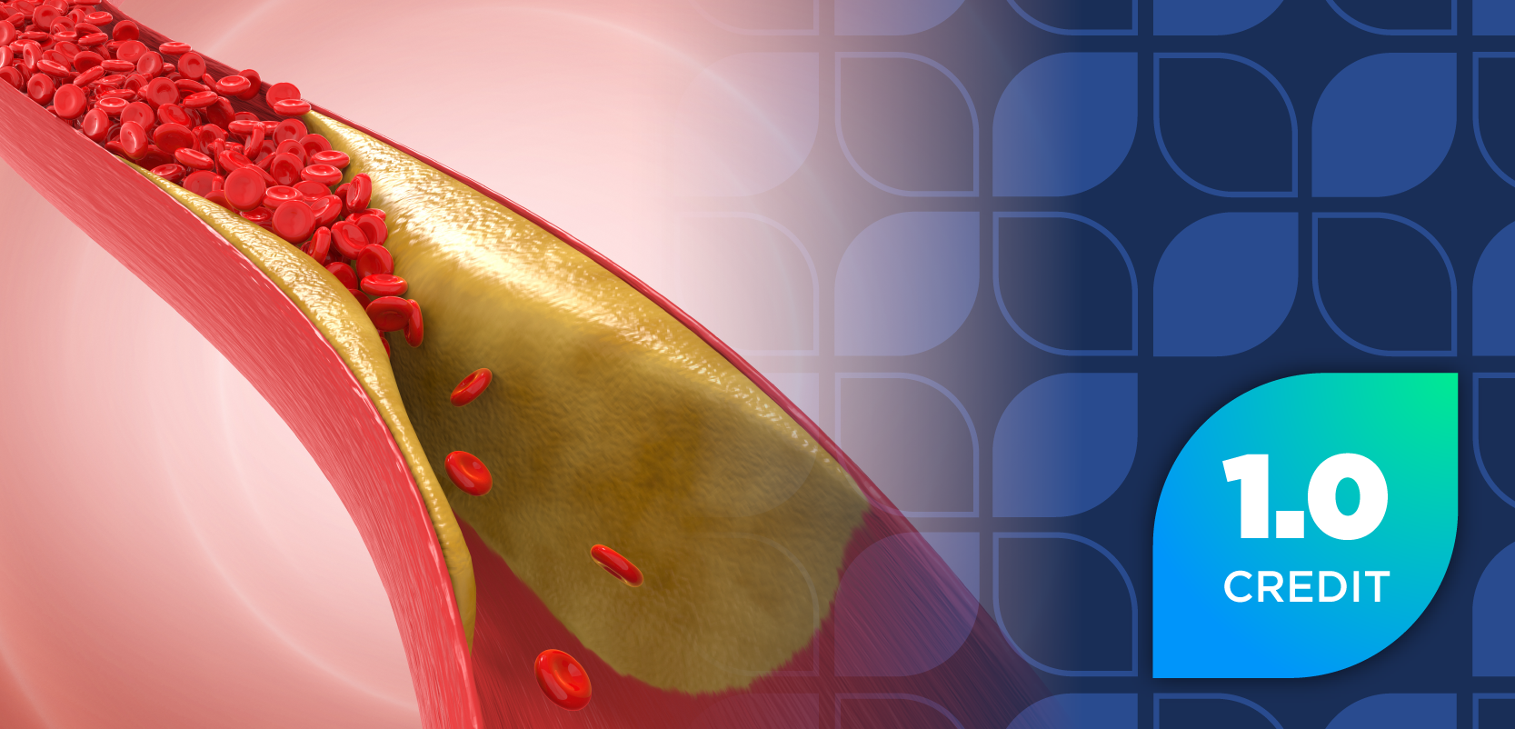 Optimizing LDL-C Lowering and Adherence to Hyperlipidemia Guidelines