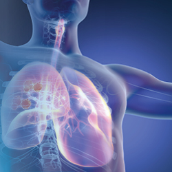 The Evolving Treatment Landscape for ALK-Positive Metastatic Non-Small Cell Lung Cancer: Supportive Care Considerations for Specialty Pharmacists