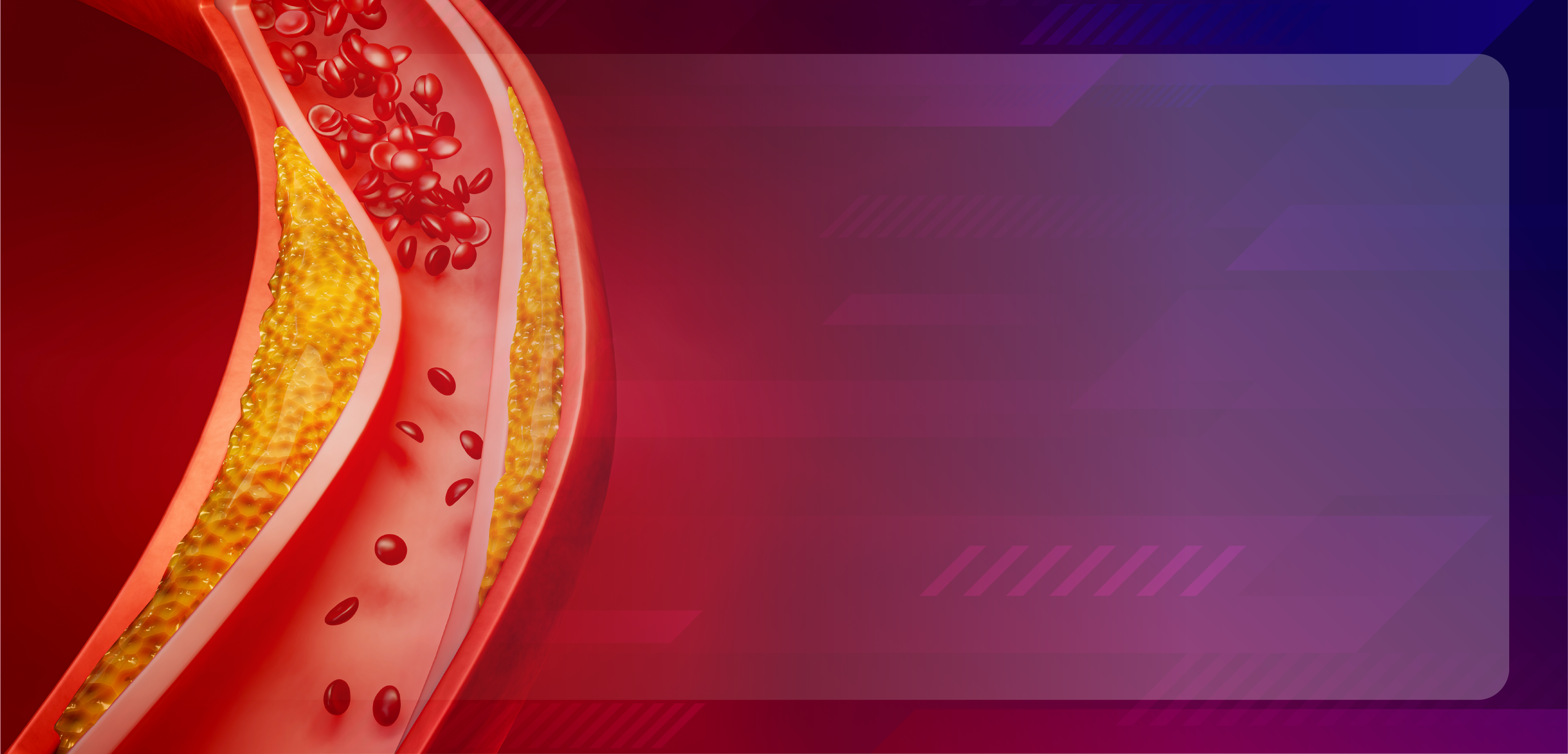 Therapies in Lowering LDL-Cholesterol Levels for the Primary and Secondary Prevention of Atherosclerotic Cardiovascular Disease