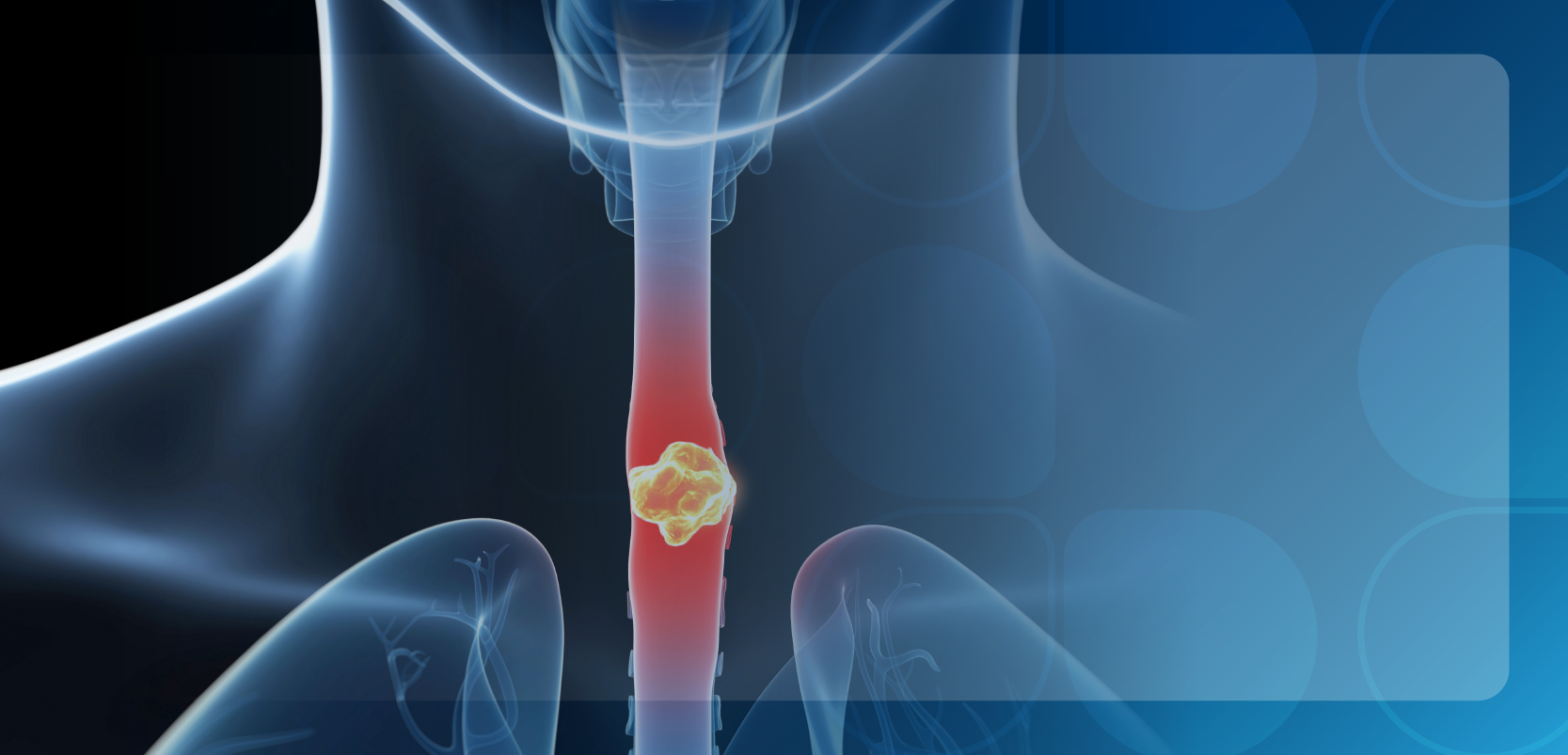 Emerging Biologic Therapy for the Treatment of Eosinophilic Esophagitis in the Pediatric Population